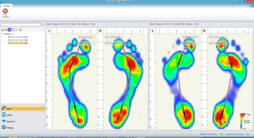 GaitScan-Comparison