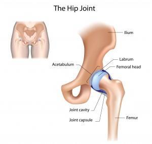 HIP-JOINT